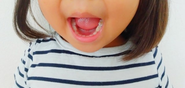 歯がすり減る・欠ける可能性もある？気になる症状に対応する方法