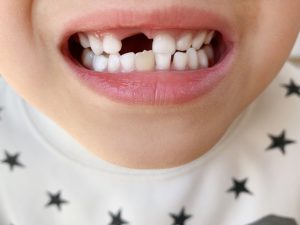 永久歯が生えてこない？考えられる原因と受診タイミング
