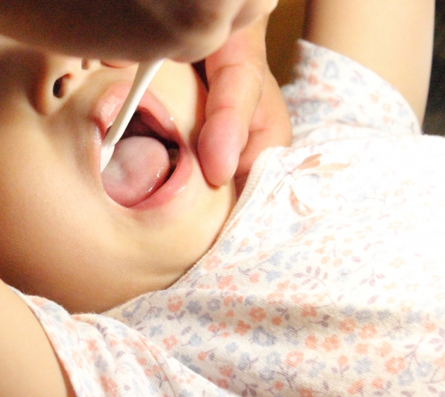 お子さまの乳歯をむし歯から守るための徹底ガイド